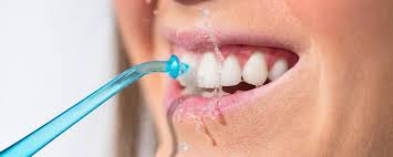 Teeth Cleaning